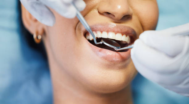 Best Broken or Chipped Tooth Repair in Little Ferry, NJ